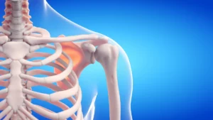 Articulação glenoumeral: pilar da mobilidade do ombro