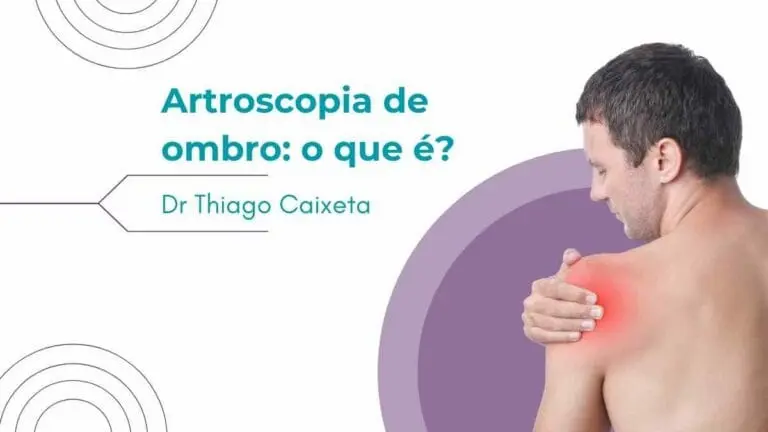 Artroscopia de ombro