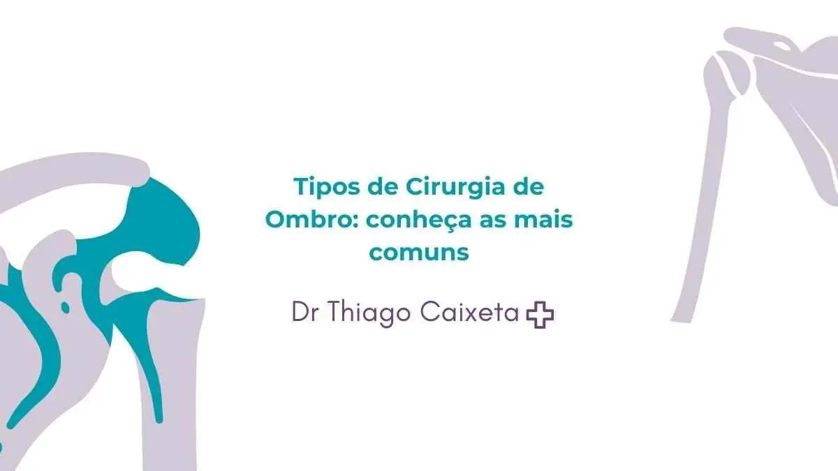 Tipos de Cirurgia de Ombro