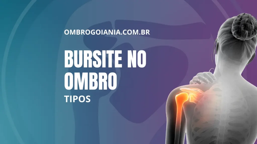 Tipos de bursite no ombro