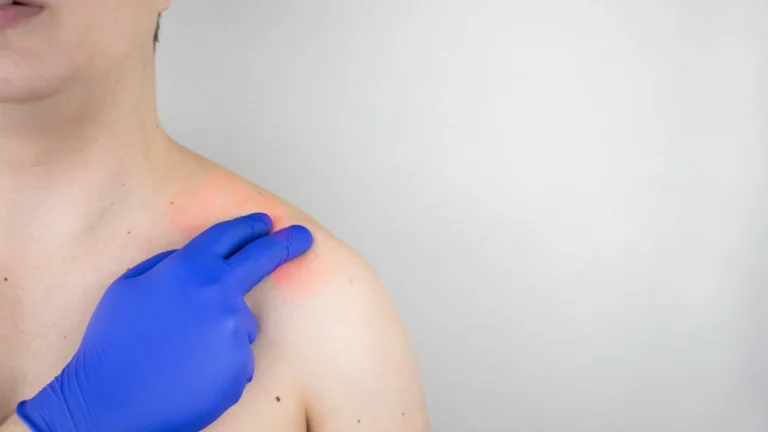 Valor de Cirurgia no Ombro